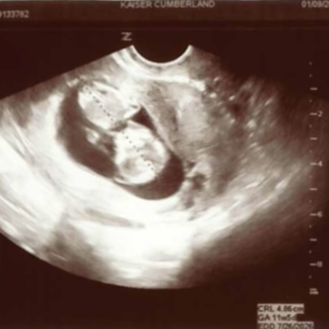 Photo shared by Abigail for their Babylist baby registry.