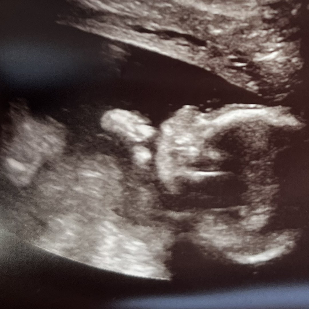 Photo shared by Cheyanne for their Babylist baby registry.