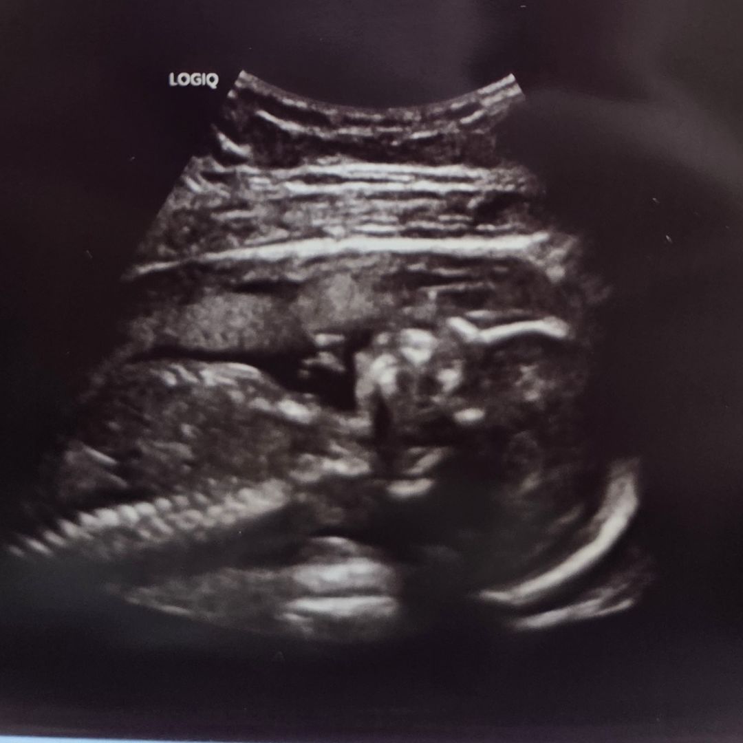 Photo shared by Hannah for their Babylist baby registry.