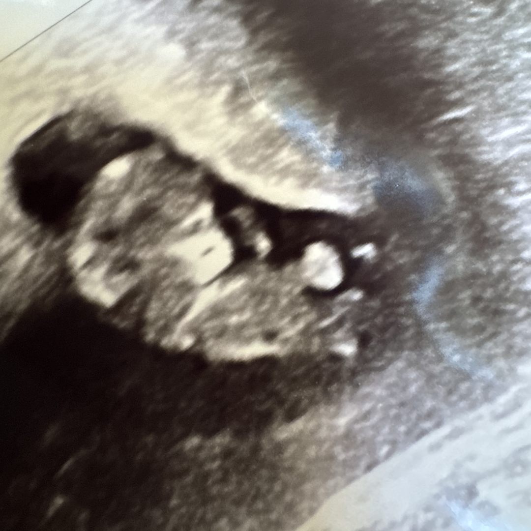 Photo shared by Sara for their Babylist baby registry.