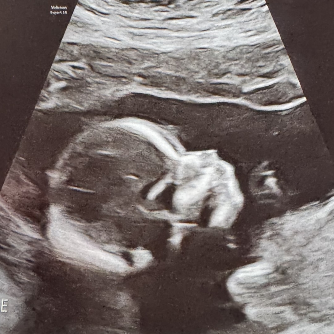 Photo shared by Romelia for their Babylist baby registry.