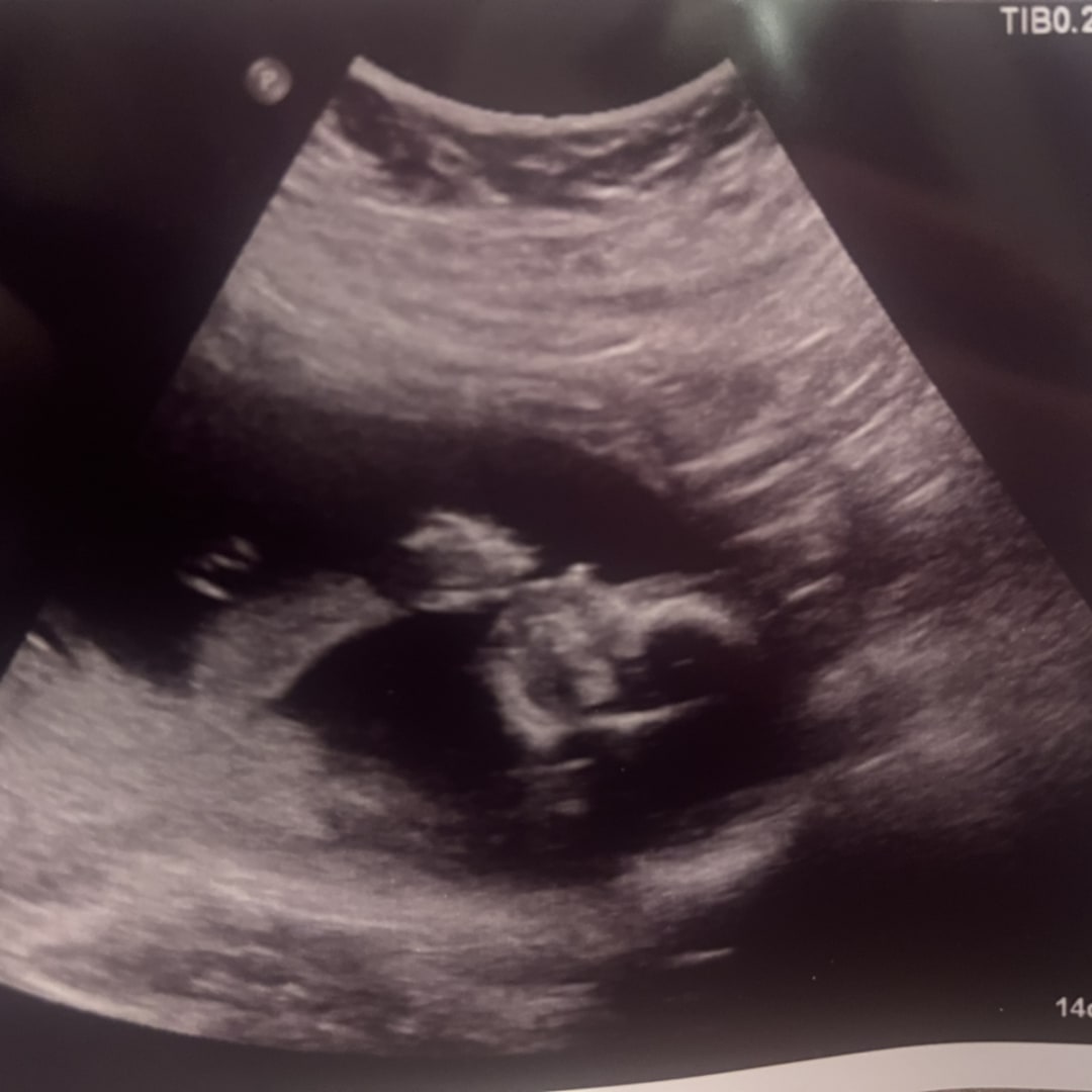 Photo shared by Katie for their Babylist baby registry.