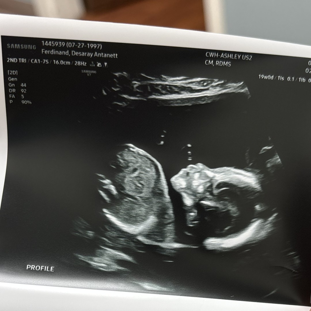 Photo shared by Desaray for their Babylist baby registry.