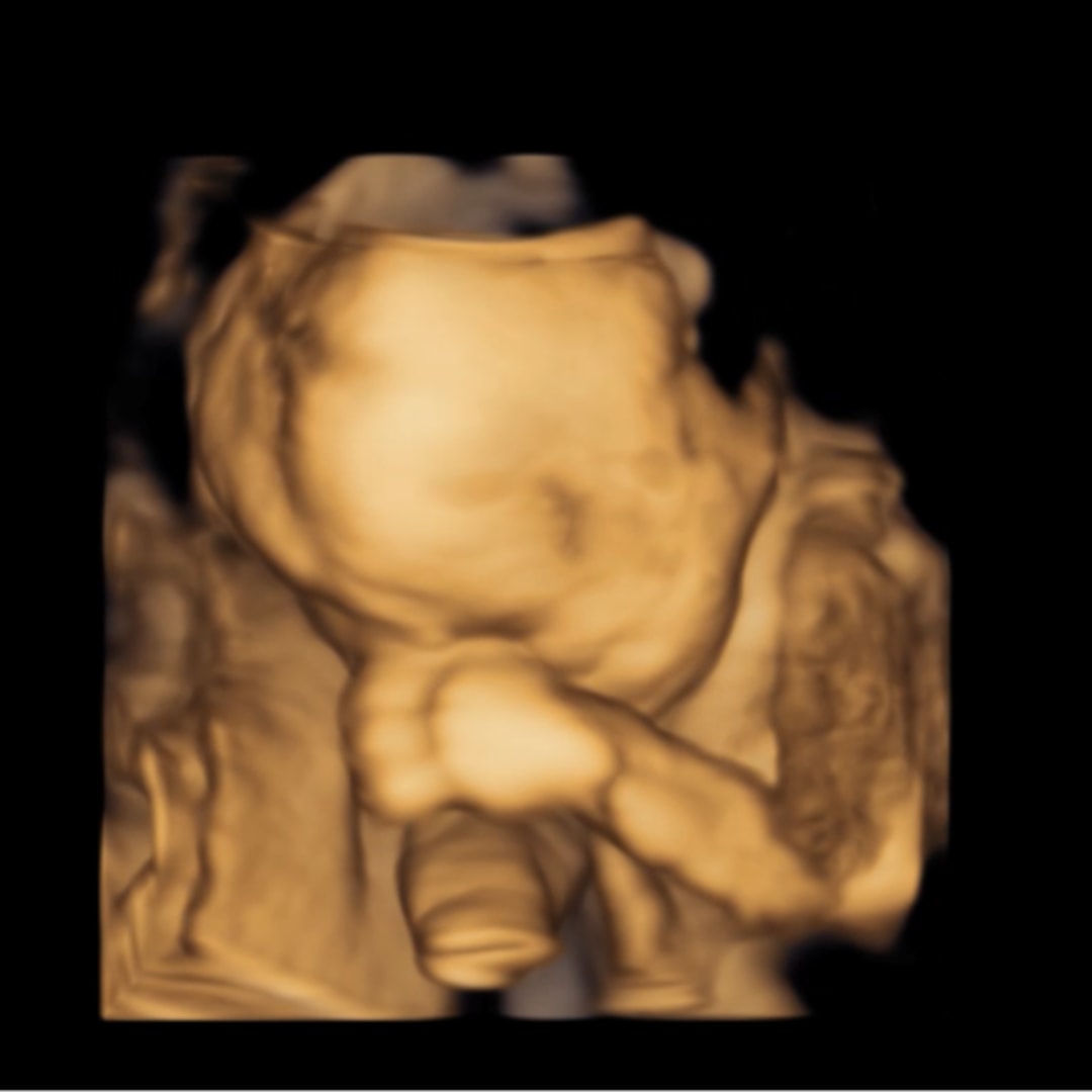 Photo shared by Elizabeth for their Babylist baby registry.