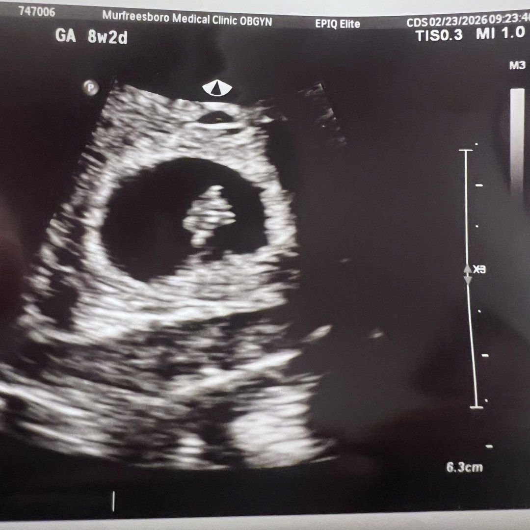 Photo shared by Emily for their Babylist baby registry.