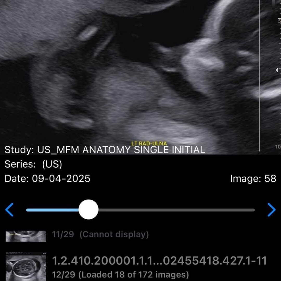 Photo shared by Hillary for their Babylist baby registry.