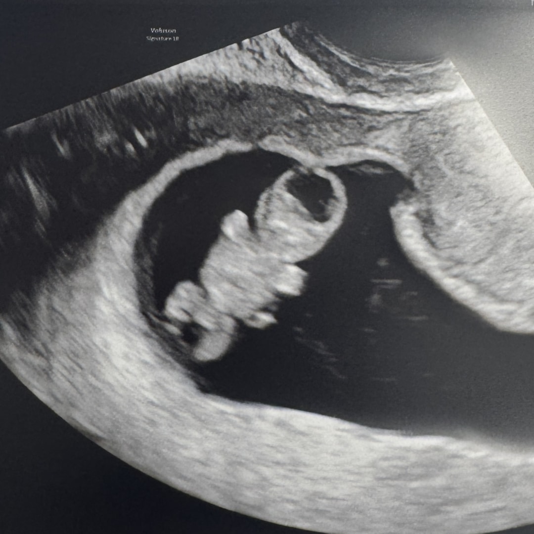 Photo shared by Lauren for their Babylist baby registry.