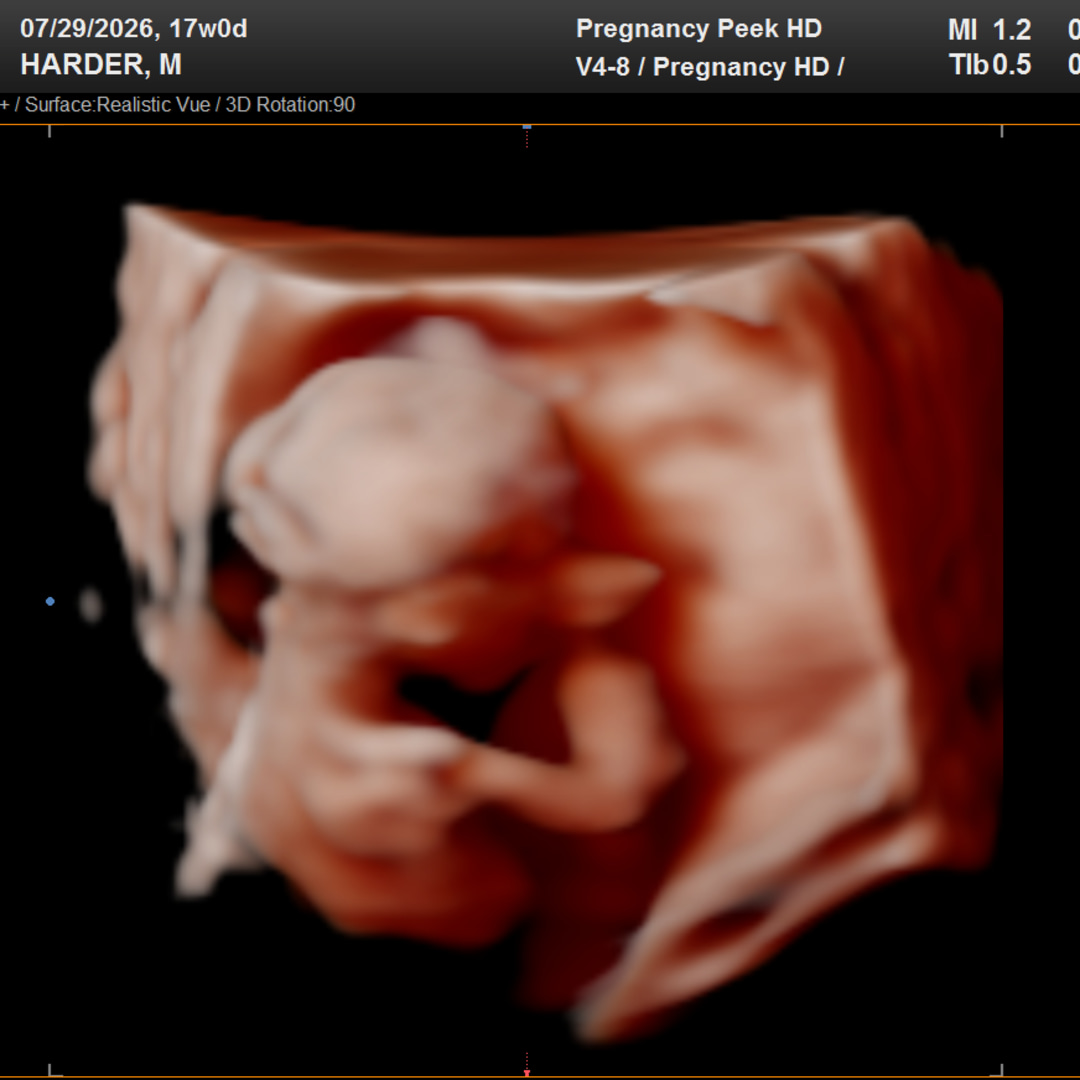 Photo shared by Mary-Harbin for their Babylist baby registry.