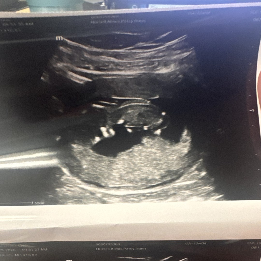 Photo shared by Alexis for their Babylist baby registry.