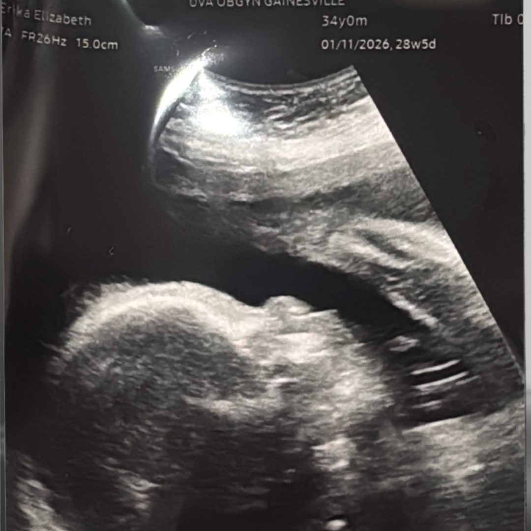 Photo shared by Erika for their Babylist baby registry.