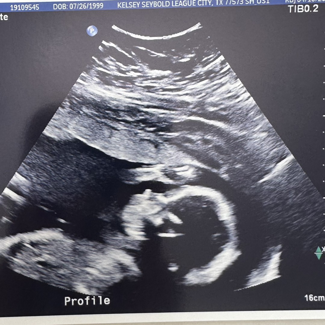 Photo shared by Kaylee & Max for their Babylist baby registry.
