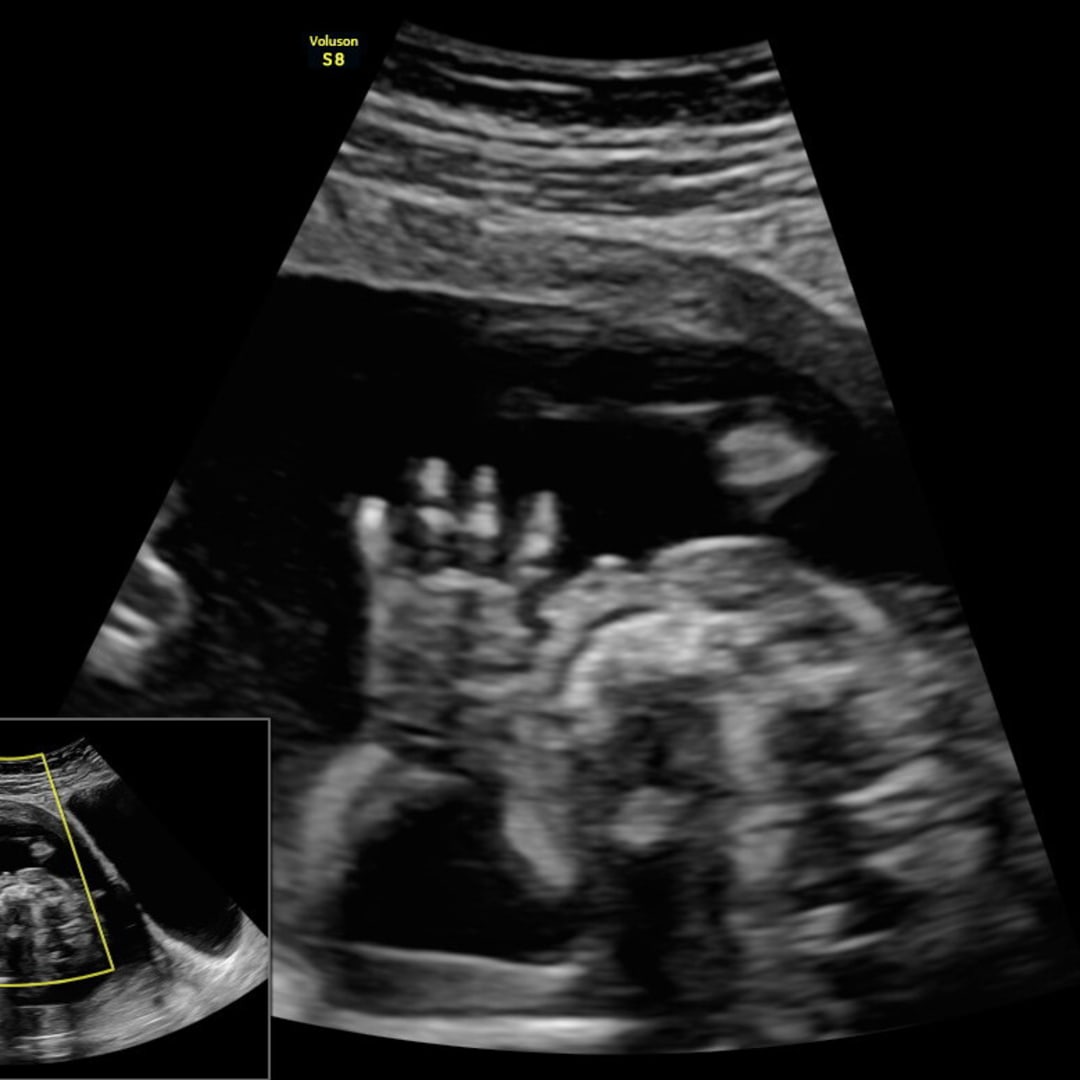 Photo shared by Heaven for their Babylist baby registry.