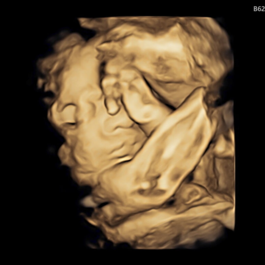 Photo shared by Alexis for their Babylist baby registry.