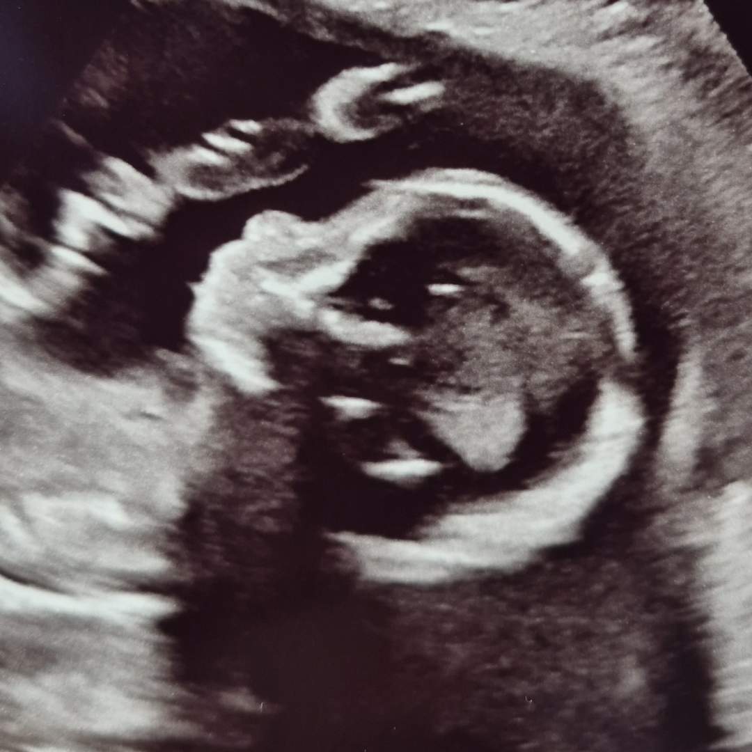 Photo shared by Ciara for their Babylist baby registry.
