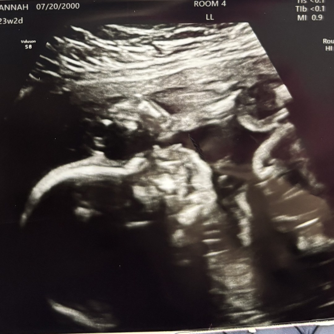 Photo shared by Hannah for their Babylist baby registry.