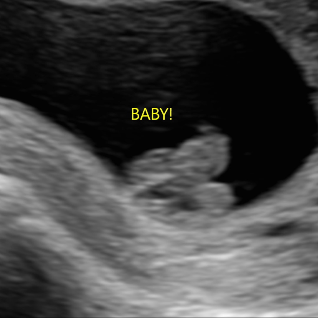 Photo shared by Daniela for their Babylist baby registry.