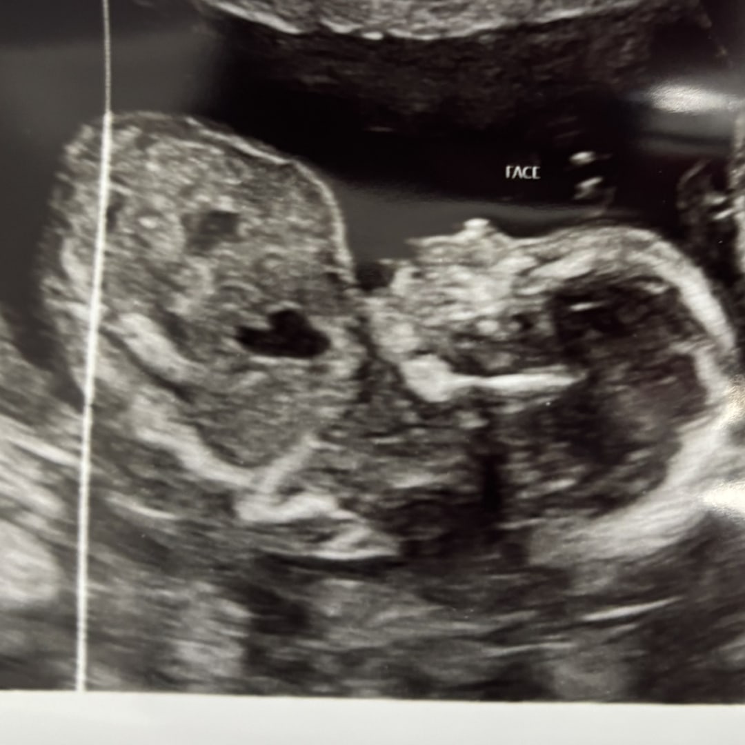 Photo shared by Alexandria for their Babylist baby registry.
