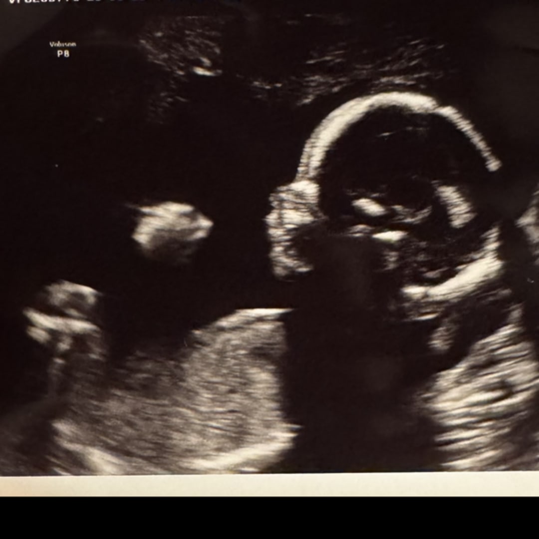 Photo shared by Randell for their Babylist baby registry.