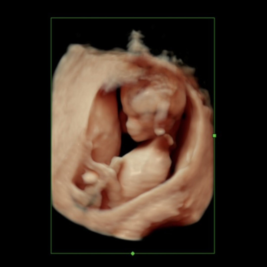 Photo shared by Alyson for their Babylist baby registry.