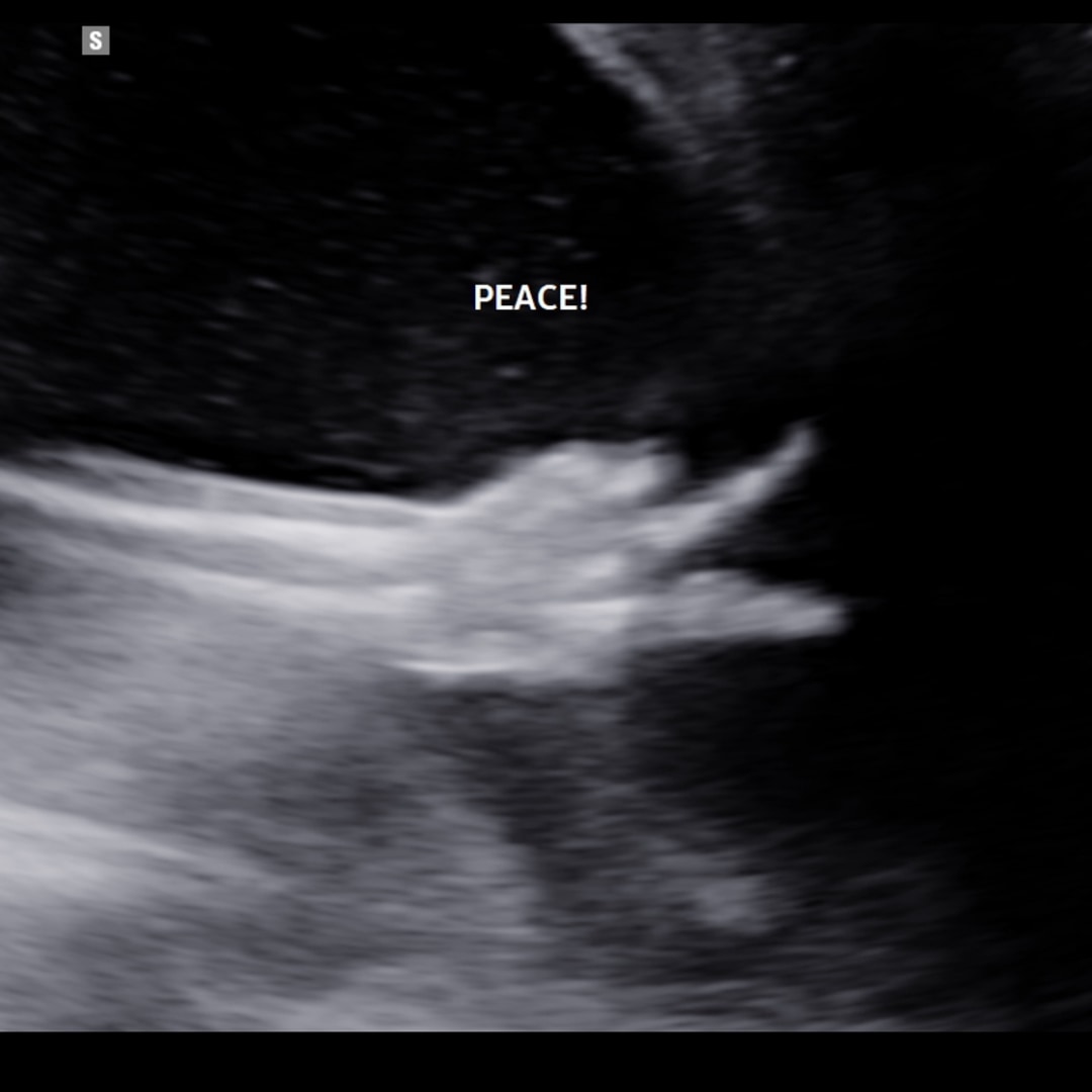 Photo shared by Destinee for their Babylist baby registry.