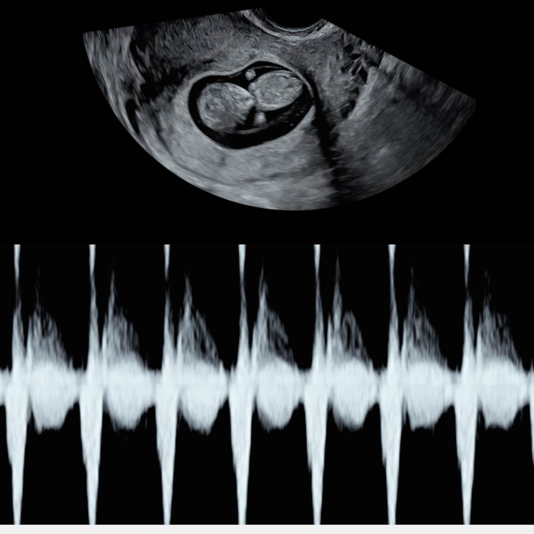 Photo shared by Erin for their Babylist baby registry.