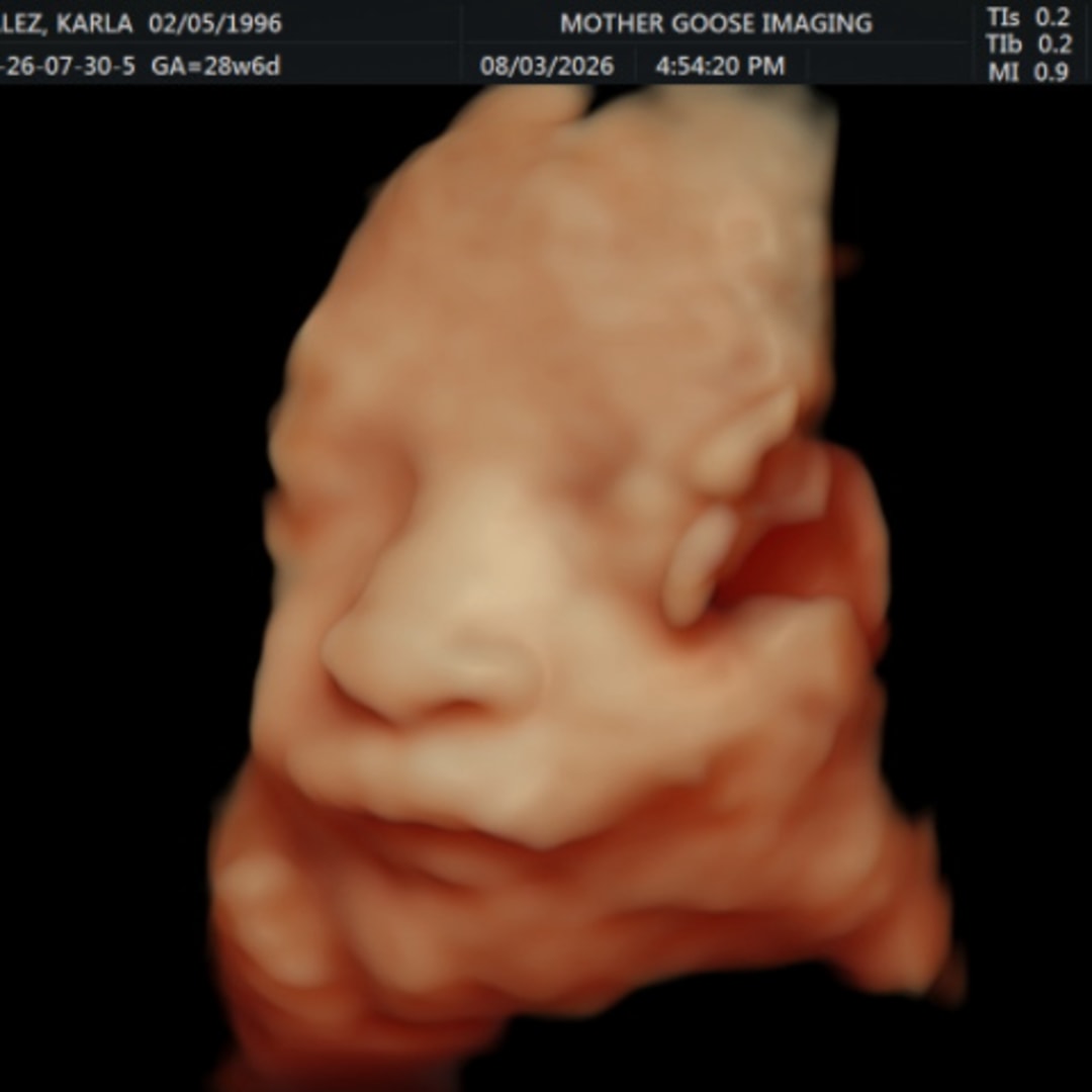 Photo shared by Karla for their Babylist baby registry.