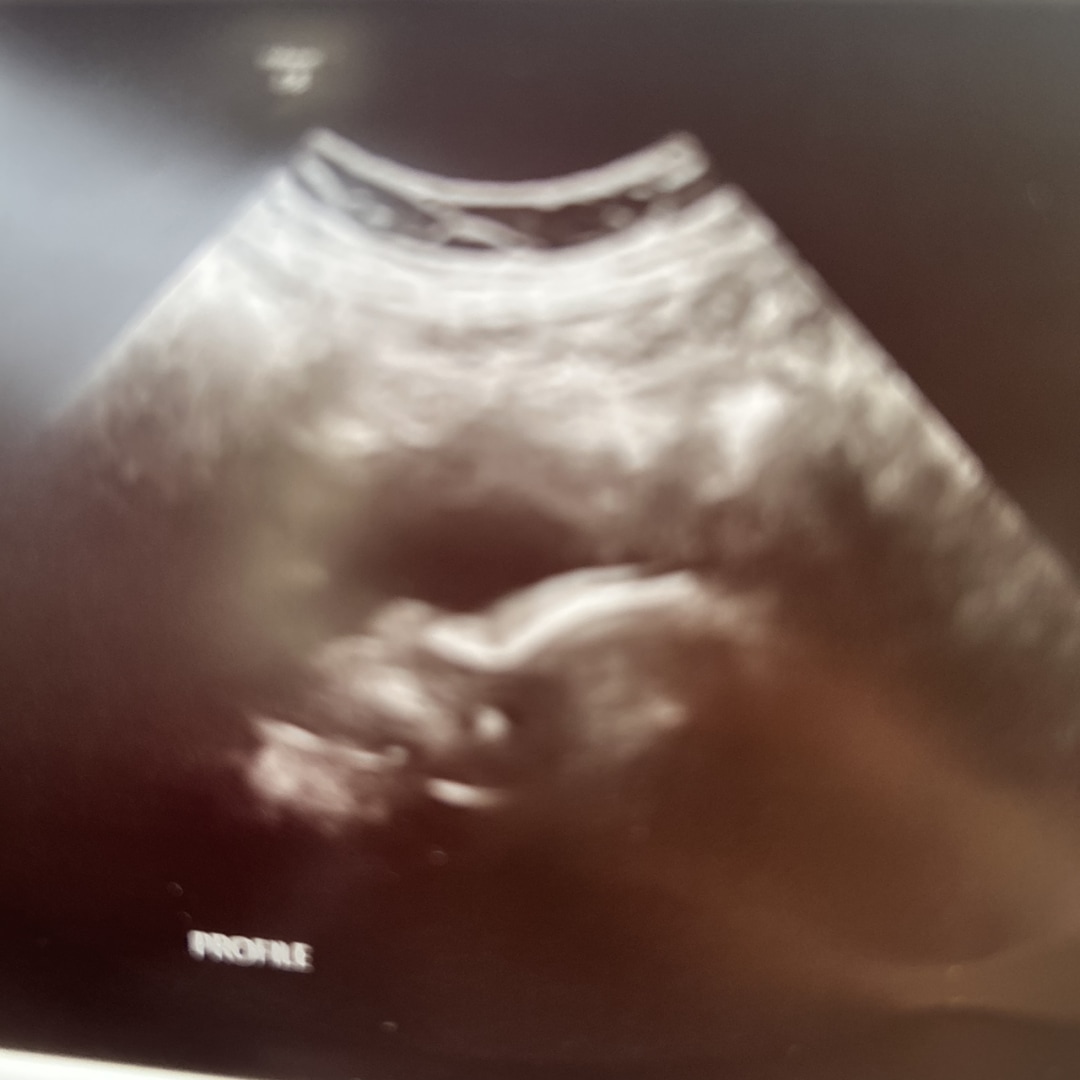 Photo shared by Marisol for their Babylist baby registry.