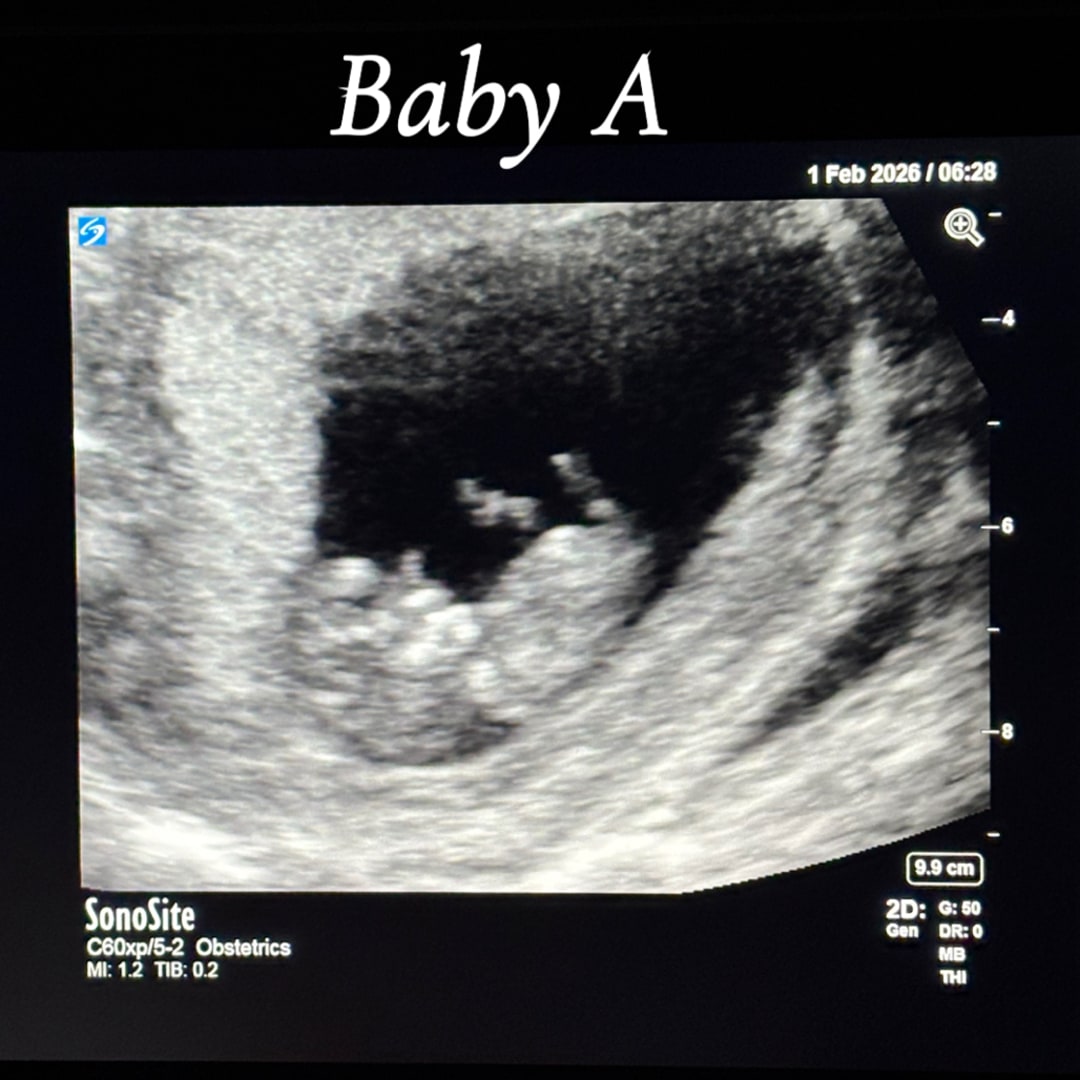 Photo shared by Hilarie for their Babylist baby registry.