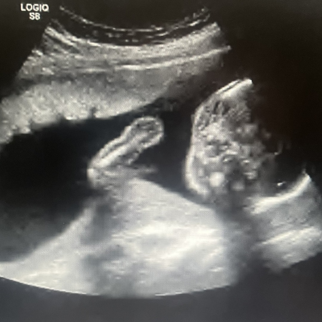 Photo shared by Jaclyn for their Babylist baby registry.