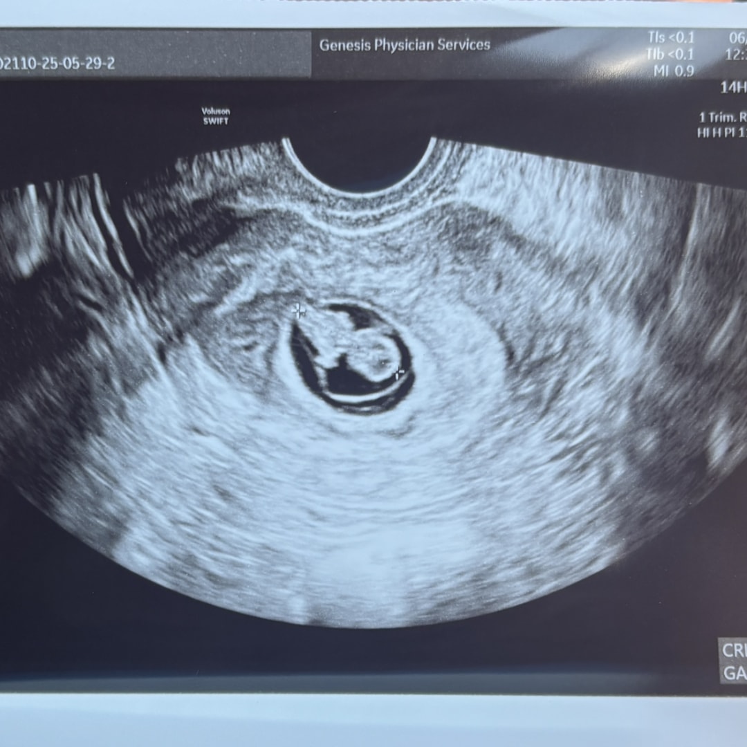 Photo shared by Aliyah for their Babylist baby registry.