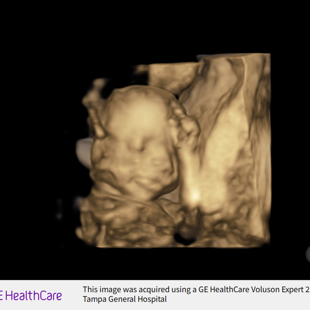 Photo shared by Barbara for their Babylist baby registry.