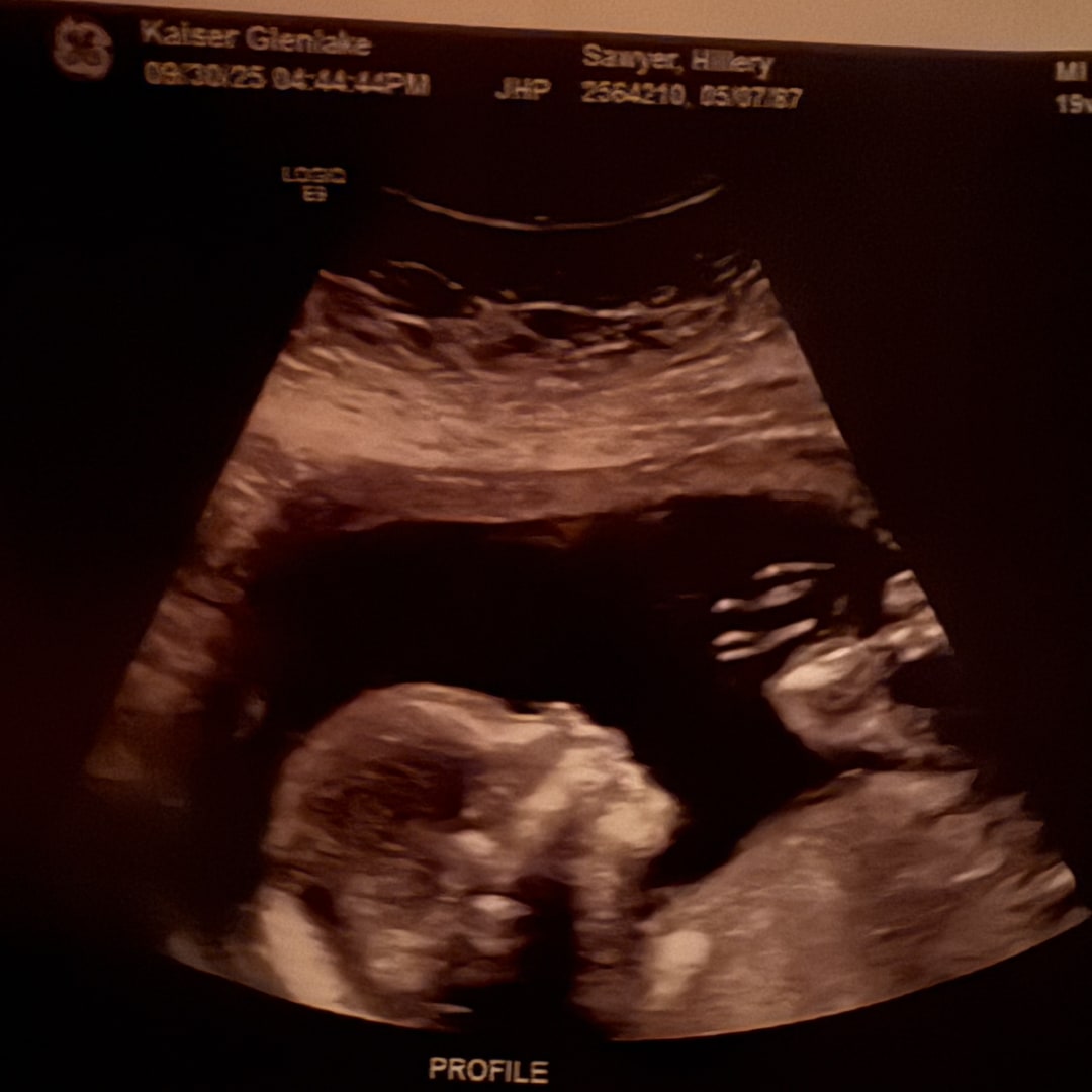 Photo shared by Hill for their Babylist baby registry.