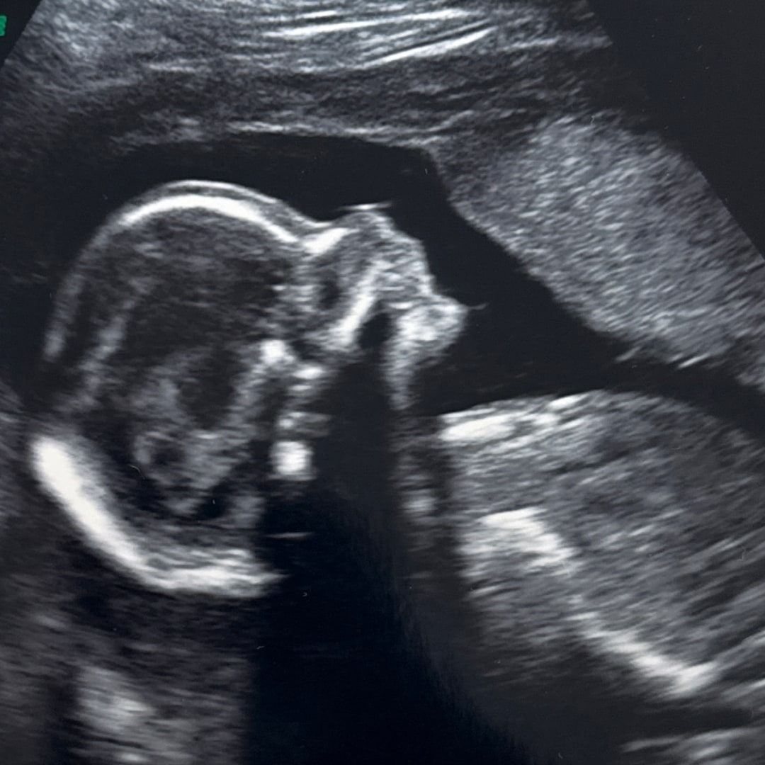 Photo shared by Krista for their Babylist baby registry.