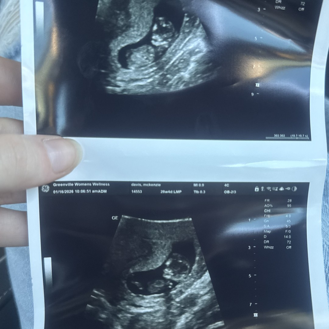 Photo shared by Kenzie for their Babylist baby registry.