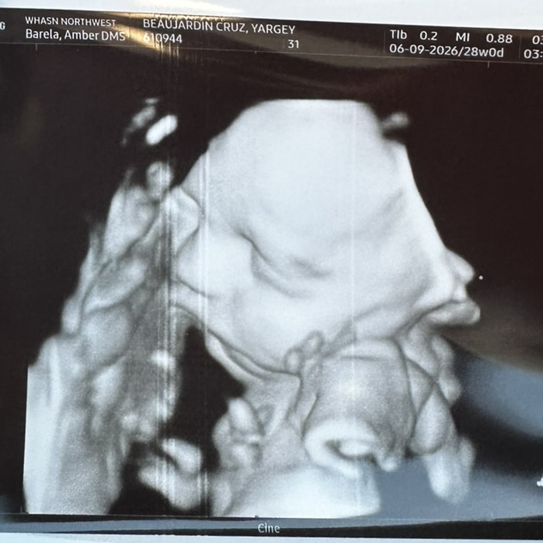 Photo shared by Yargey for their Babylist baby registry.
