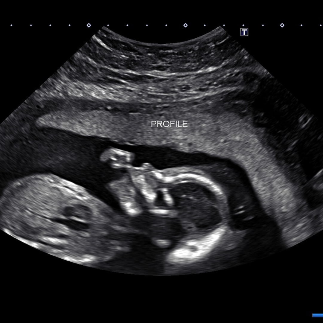 Photo shared by Jesa for their Babylist baby registry.