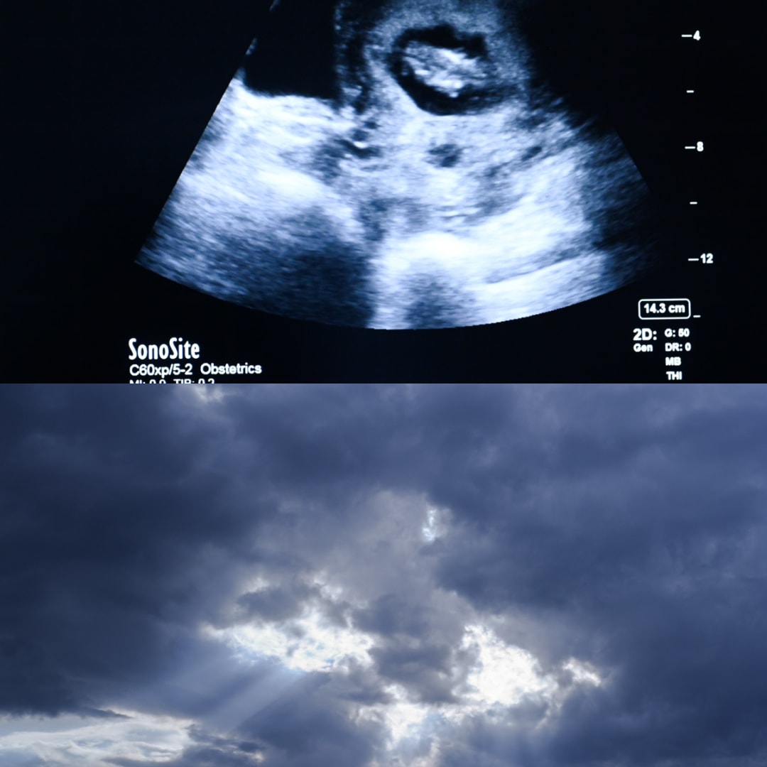 Photo shared by Elizabeth for their Babylist baby registry.
