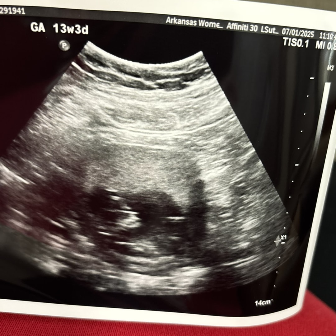 Photo shared by Bethany for their Babylist baby registry.