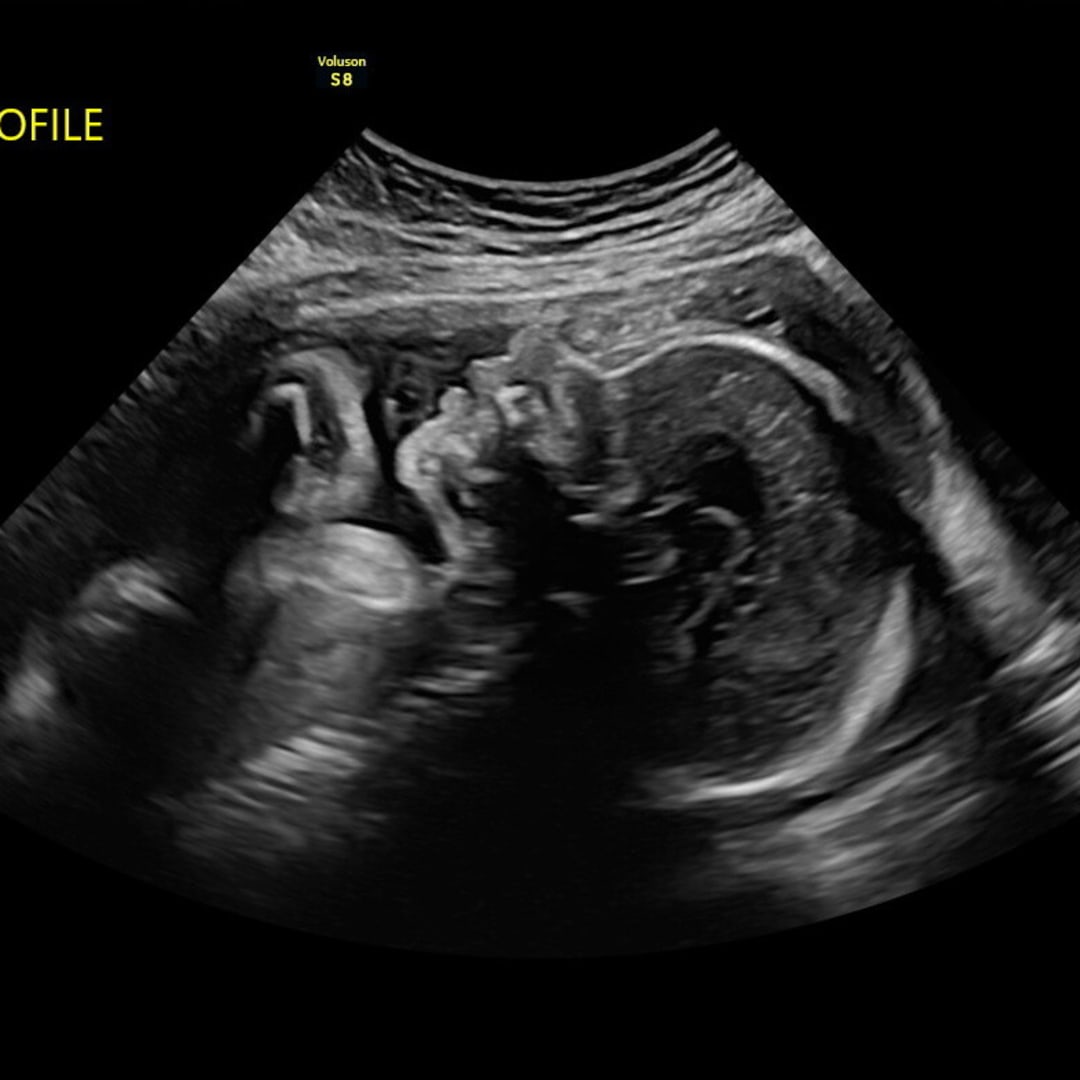 Photo shared by Caroline for their Babylist baby registry.