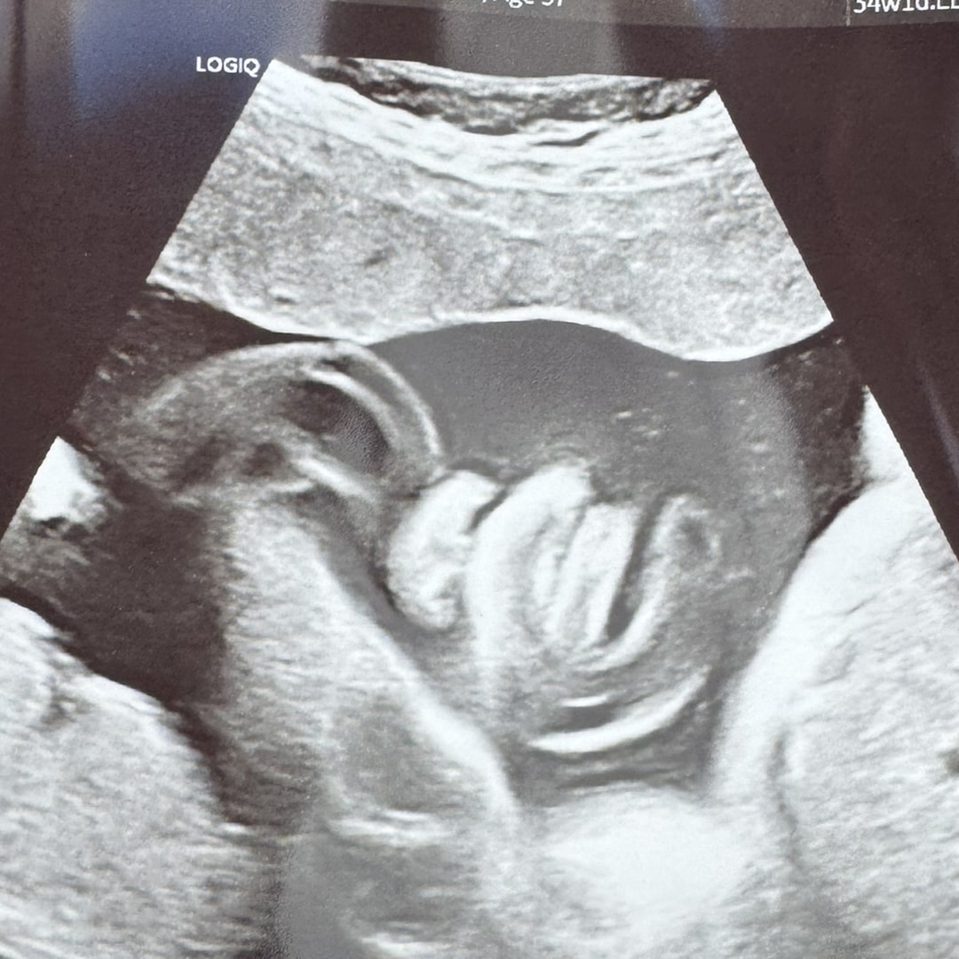 Photo shared by Frankie for their Babylist baby registry.