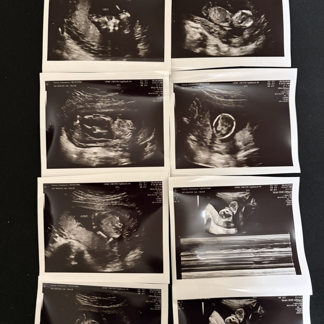 Photo shared by Gee for their Babylist baby registry.
