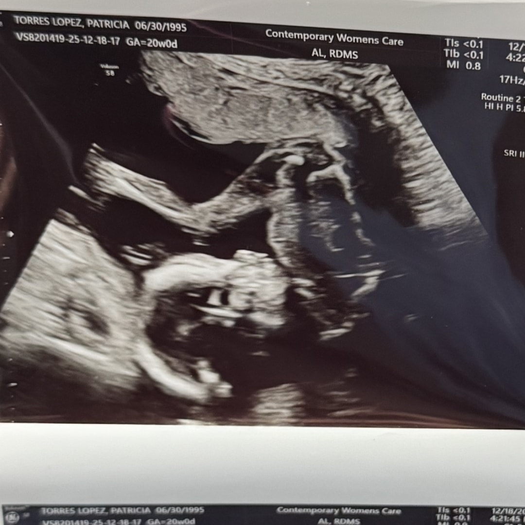 Photo shared by Patricia for their Babylist baby registry.