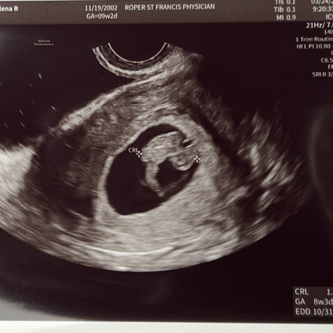 Photo shared by Elena for their Babylist baby registry.
