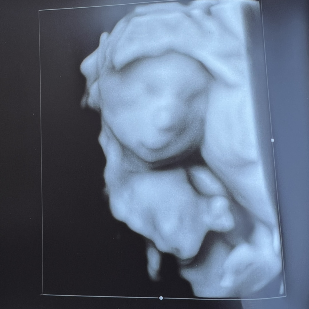 Photo shared by Danielle for their Babylist baby registry.