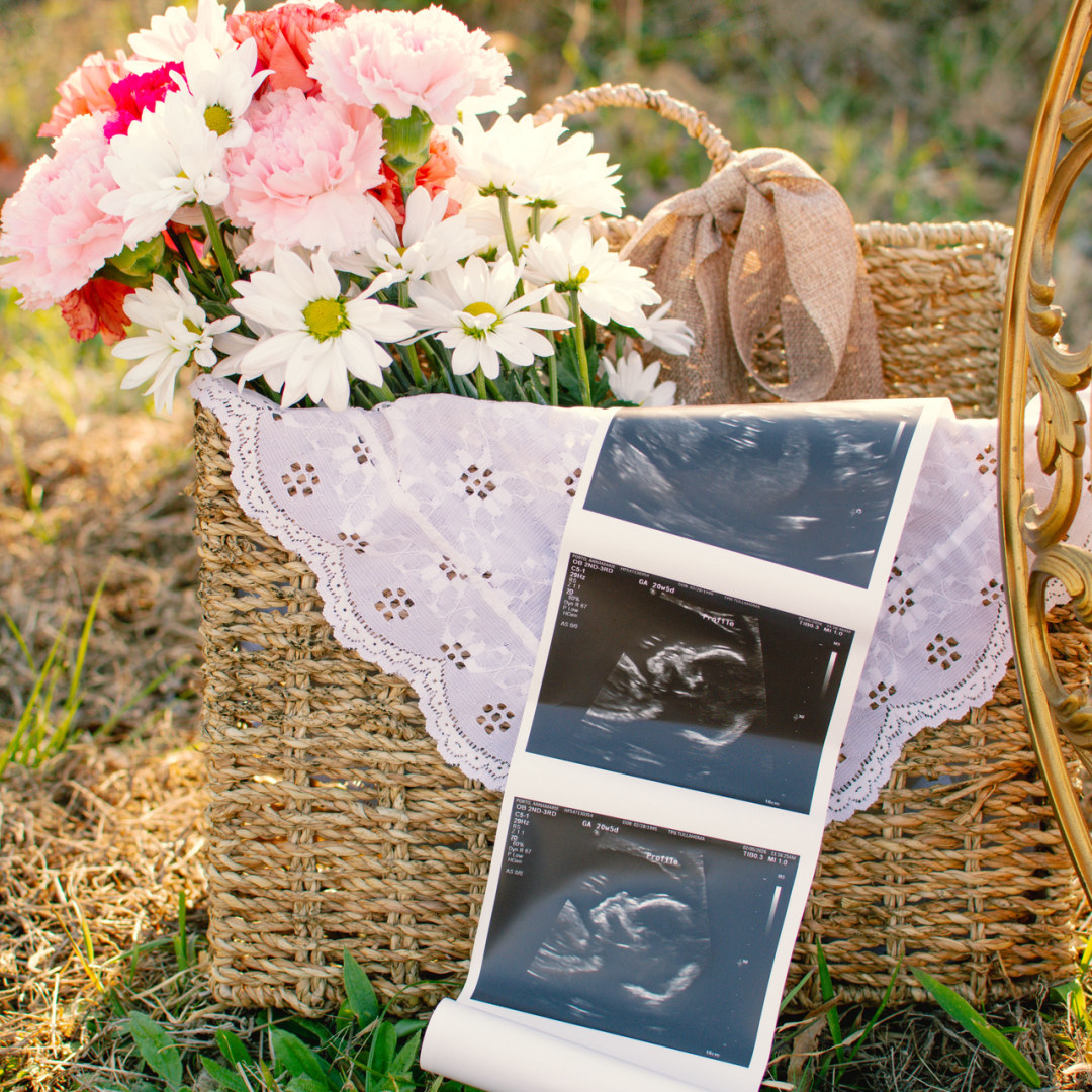 Photo shared by AnnaMarie for their Babylist baby registry.