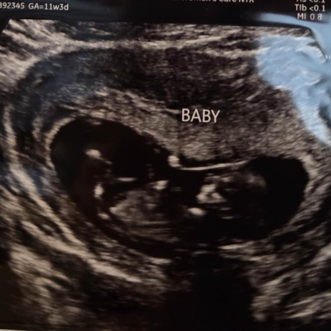 Photo shared by A&B for their Babylist baby registry.