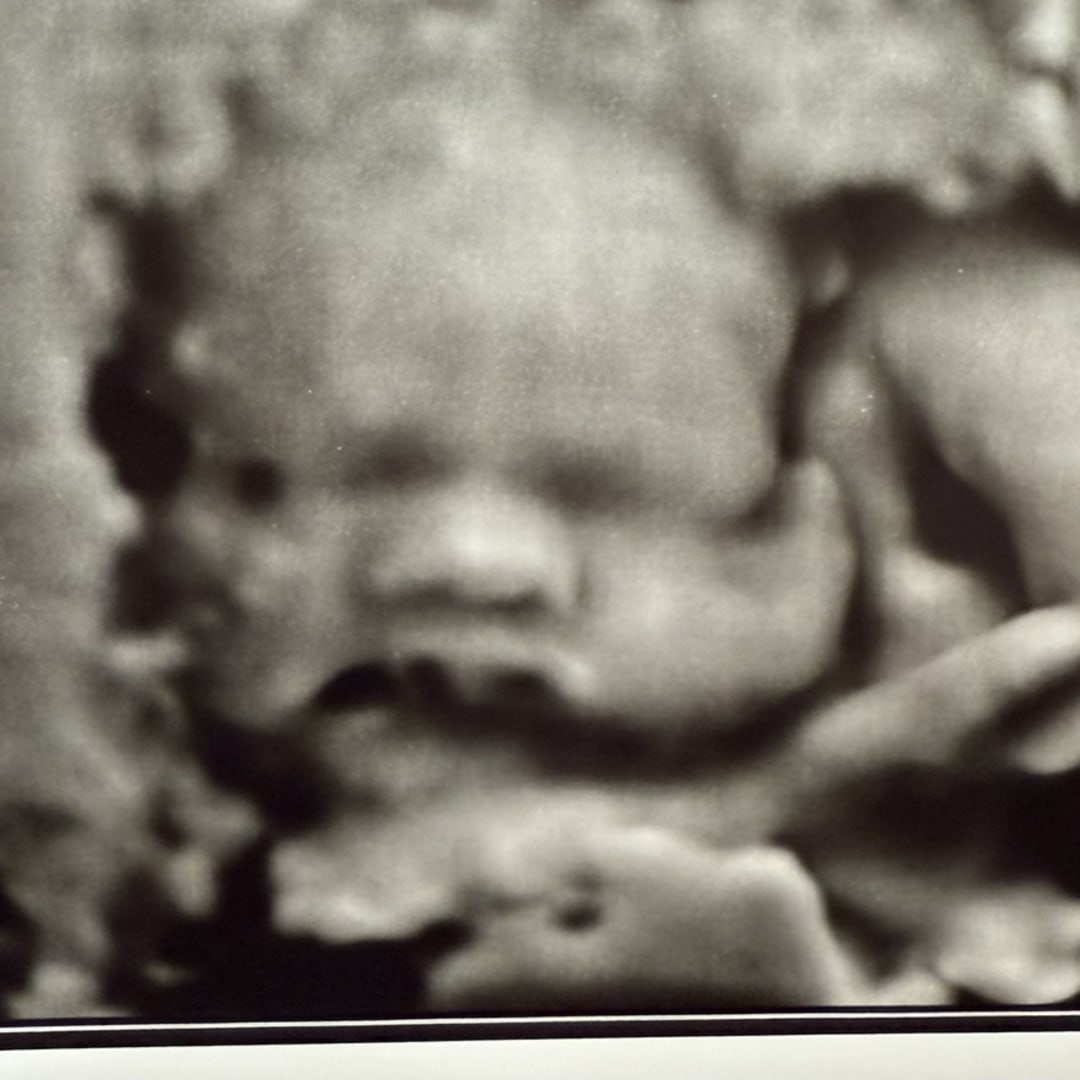 Photo shared by Allison for their Babylist baby registry.