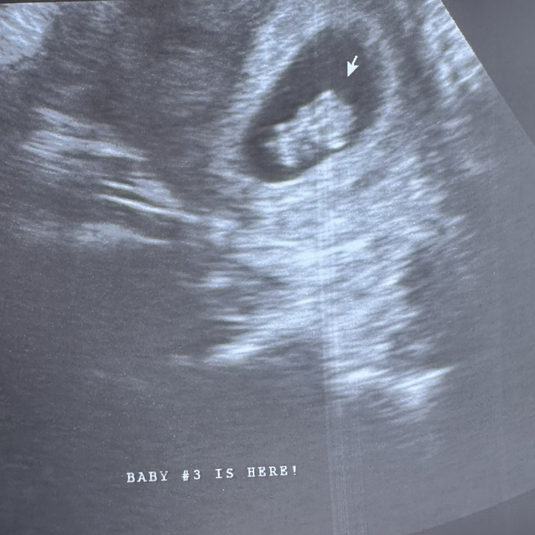 Photo shared by Kandace for their Babylist baby registry.