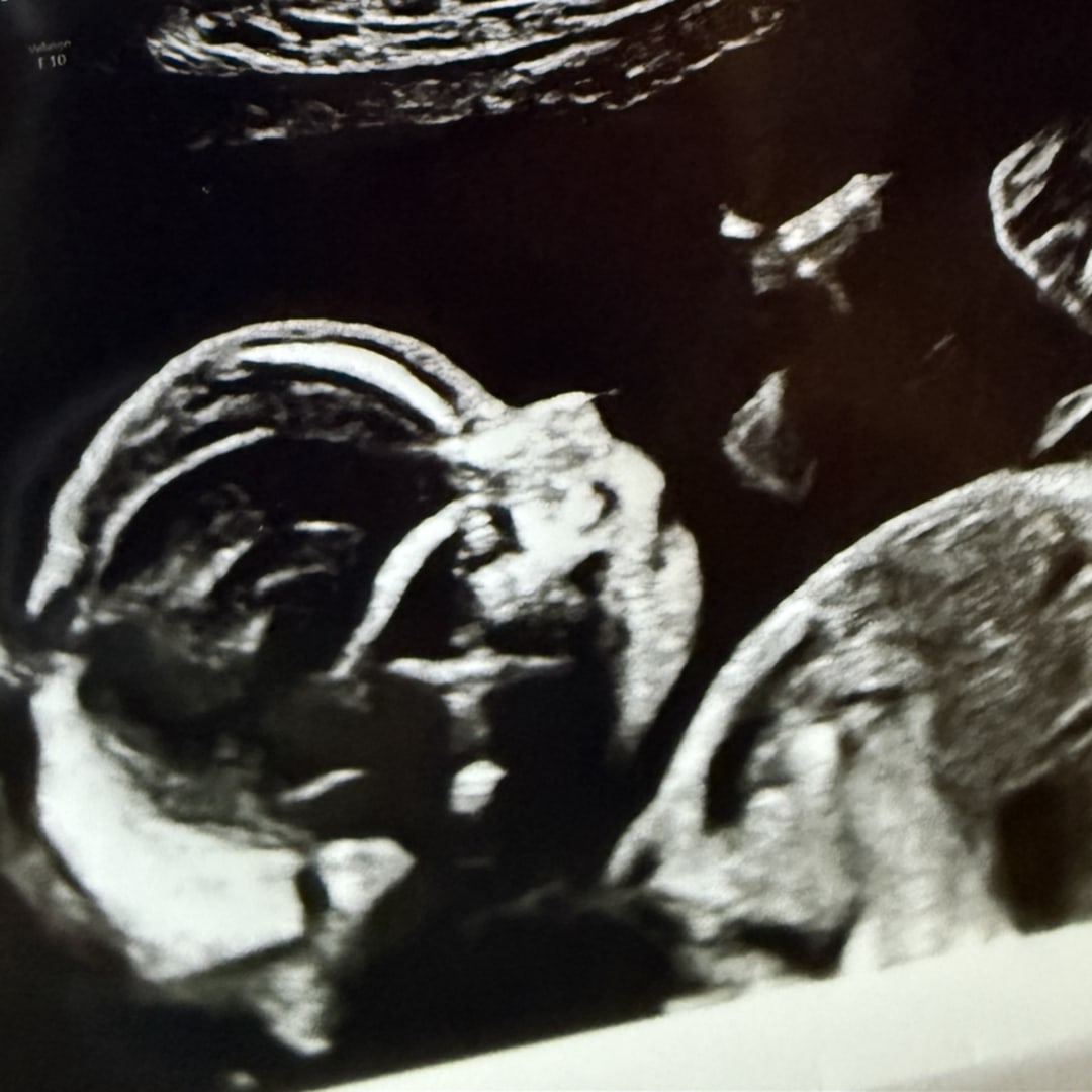Photo shared by Elisabeth for their Babylist baby registry.