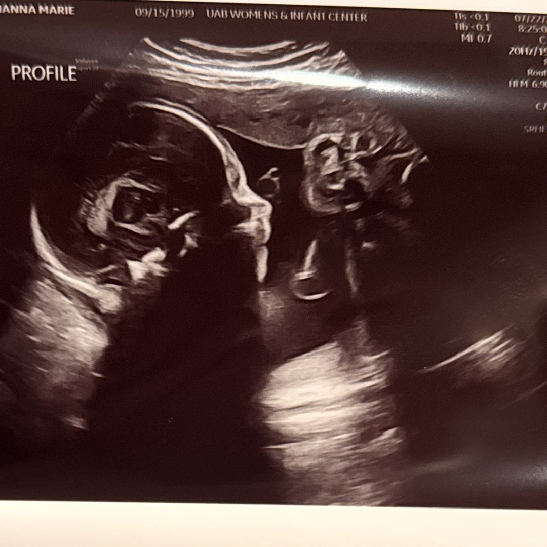 Photo shared by Alianna for their Babylist baby registry.